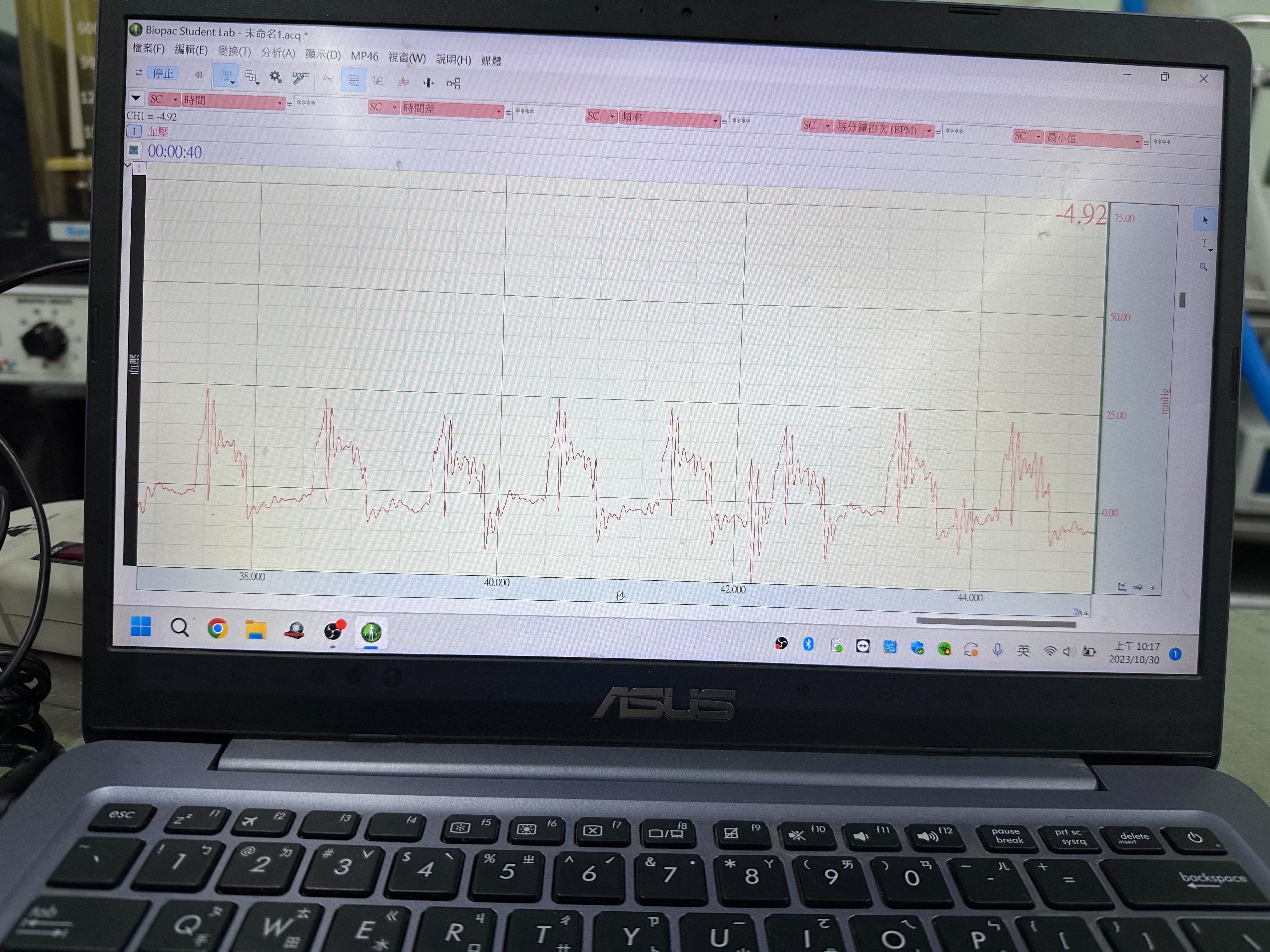 Blood Pressure Measurement